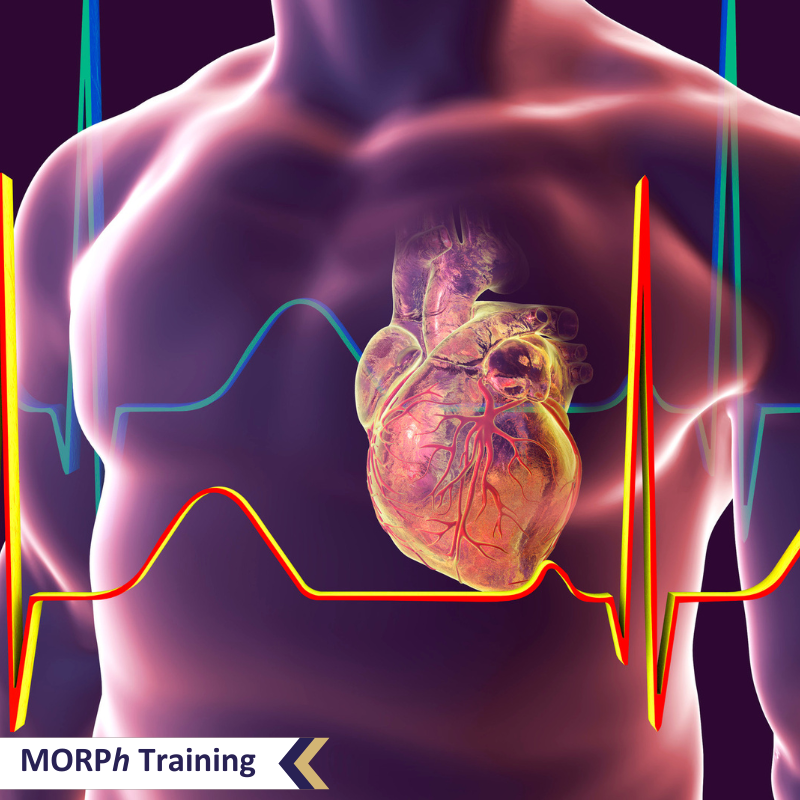 Heart Failure Academy – Module 1